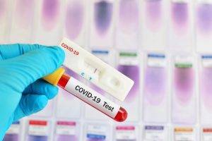 Сладкий тест на коронавирус