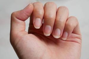 Топ-5 процедур для ломких ногтей