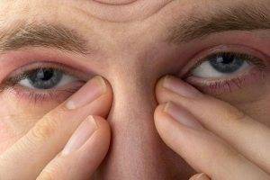 8 причин зуда в уголках глаз