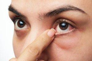7 видов лекарств, которые могут вызвать сухость глаз