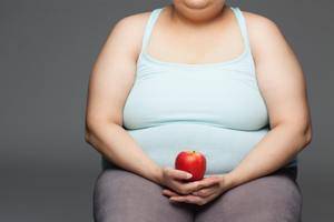 5 вопросов и ответов об ожирении