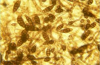 Грибок Alternaria alternata