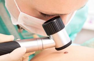 Что такое дерматоскопия