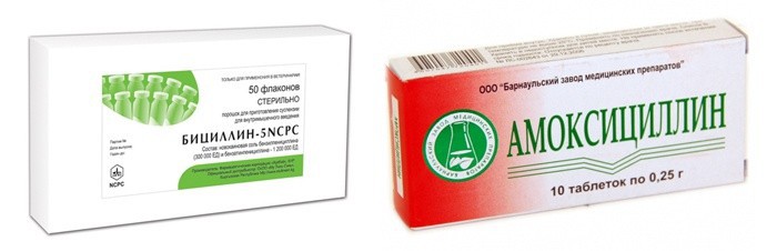 Как лечить фарингит у взрослых в домашних условиях