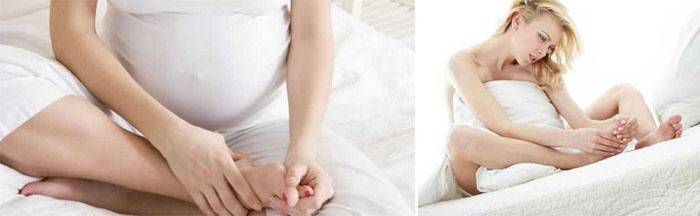 Спазмы при беременности перерастают в судороги