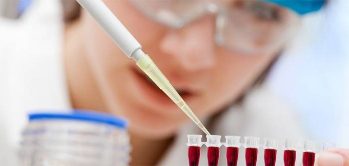 Лаборант проводит исследование крови на холестерин
