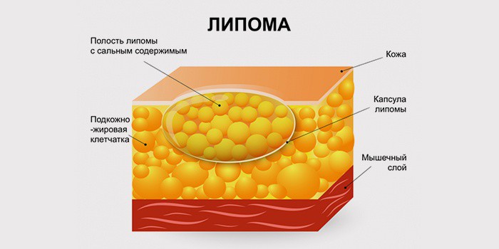 Анатомия жировика