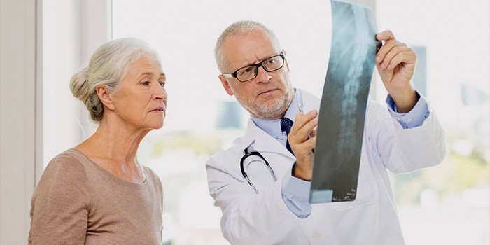 Врач и пациентка изучают рентген