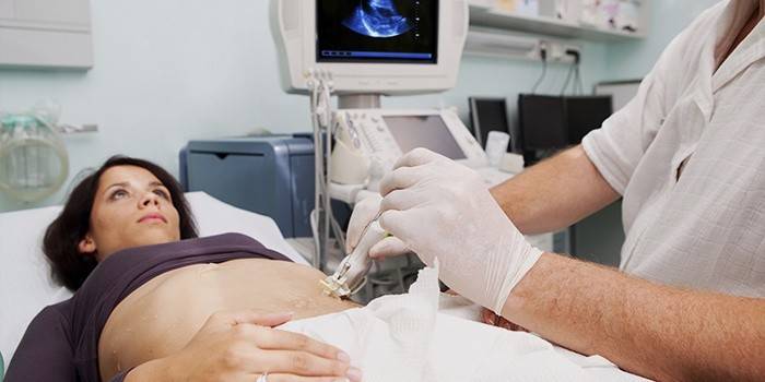 Женщина проходит УЗИ-обследование органов брюшной полости