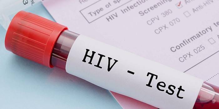 Анализ на выявление ВИЧ-инфекции