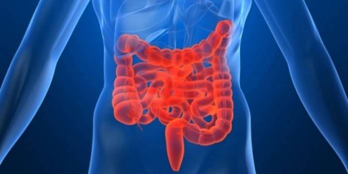 Синдром раздраженного кишечника - одна из причин дискомфорта в животе
