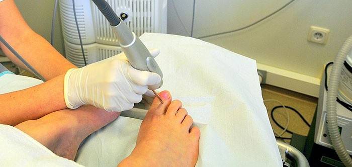 Противогрибковое лечение ногтевых пластин