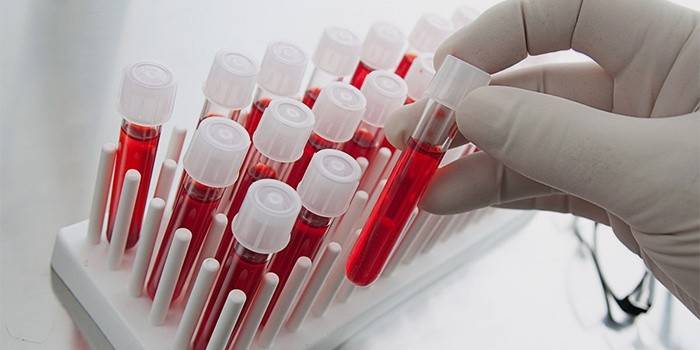 Лаборант достает анализ крови на тромбоциты