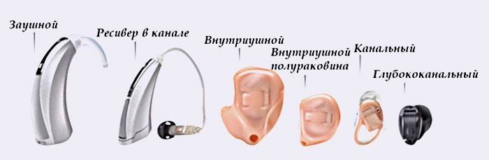 Виды слуховых устройств для пожилых людей
