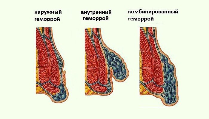 Рецепт узбекских слоеных лепешек - Лепешки от 1001 ЕДА 37 Рецепт узбекских слоеных лепешек - Лепешки от 1001 ЕДА 10