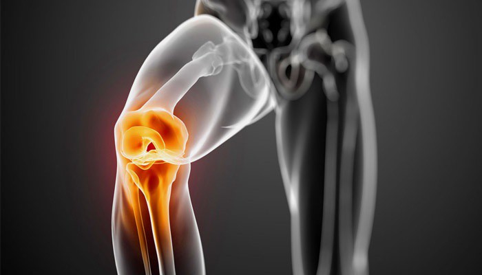 Изображение - Гонартроз коленного сустава 1 степени лечение медикаментами 6632481-2
