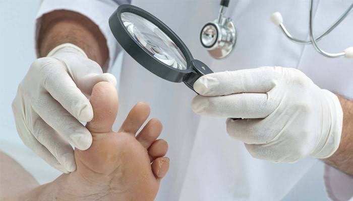 Врач-дерматолого осматривает грибок между пальцами ног у пациента