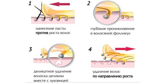 Пошаговая инструкция проведения шугаринга