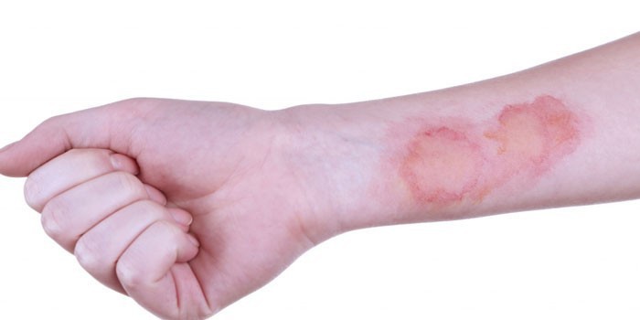 Вся правда о Хлорофиллипте подробное описание препарата, факты и заблуждения