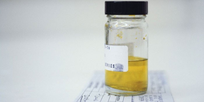 песок в мочеточнике симптомы у женщин лечение