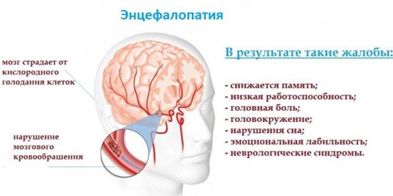 Симптомы заболевания