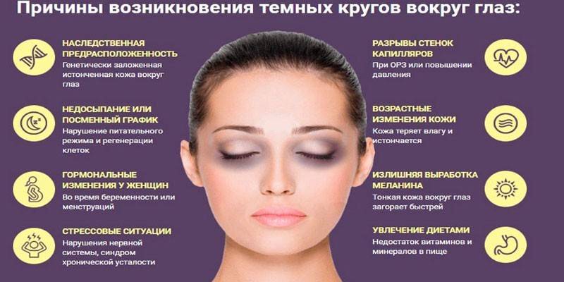 Причины появления синяков под глазами