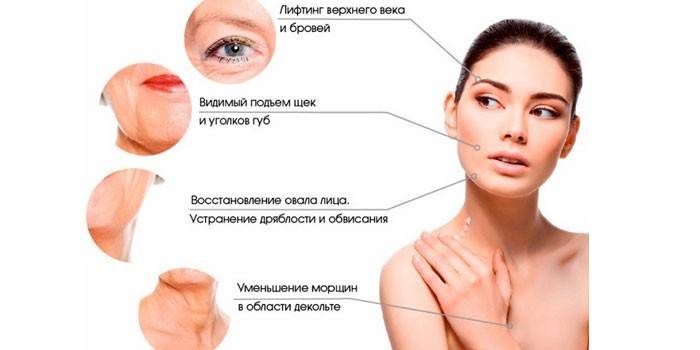 Области воздействия