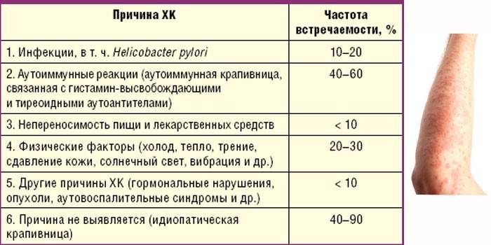 Приблизительная частота встречаемости различных причин крапивницы