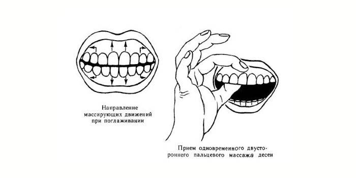 Как самостоятельно делать массаж десен