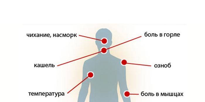 Симптомы простуды