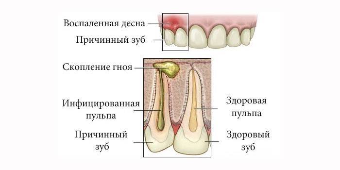 Флюс