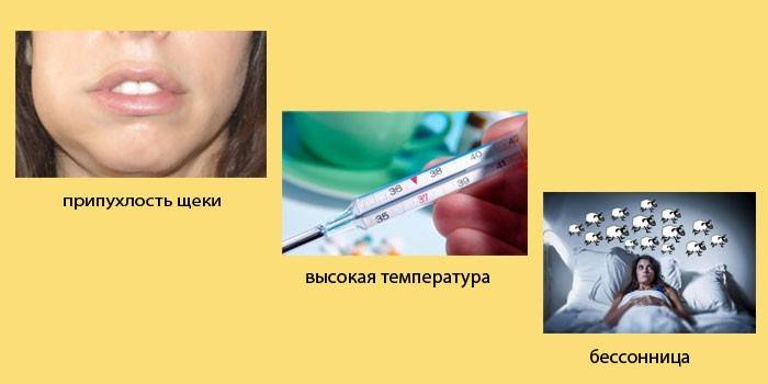 Признаки флюса