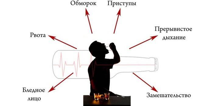 Симптомы алкогольной интоксикации