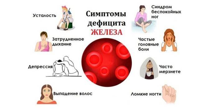 Симптомы железодефицита