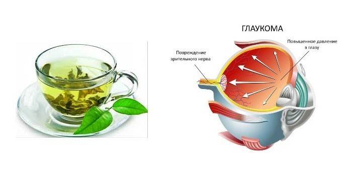 Чашка зеленого чая и глаукома