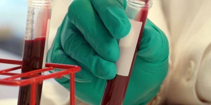 Пробирка с анализом крови в руке у лаборанта