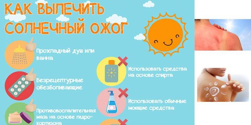 Как вылечить солнечный ожог