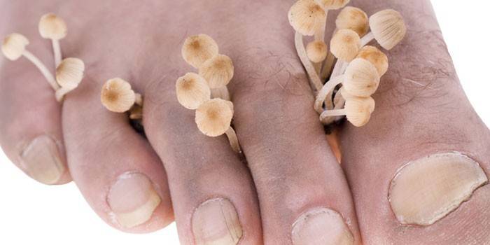 Стопа и грибы между пальцев ног