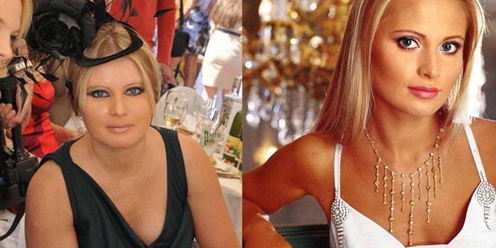 Дана Борисова до и после похудения