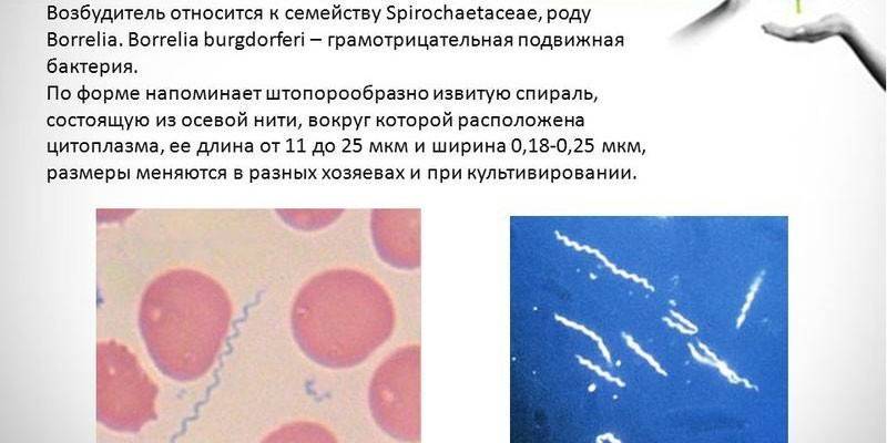 Возбудитель боррелиоза