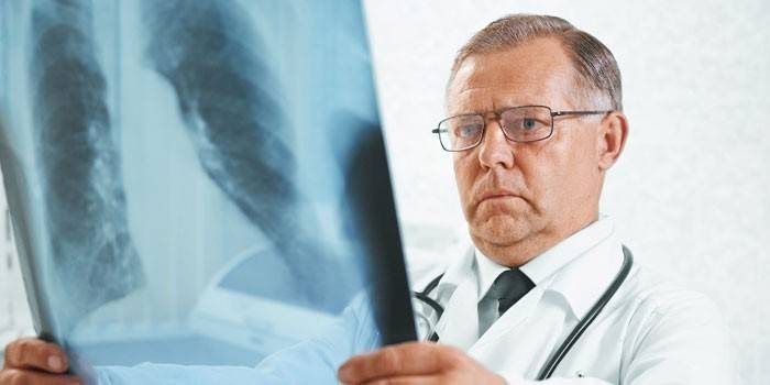 Врач смотрит на рентгеновский снимок легких