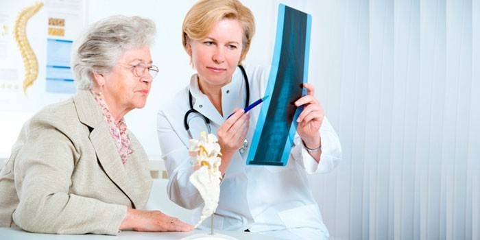 Пожилая женщина и врач рассматривают рентгеновский снимок