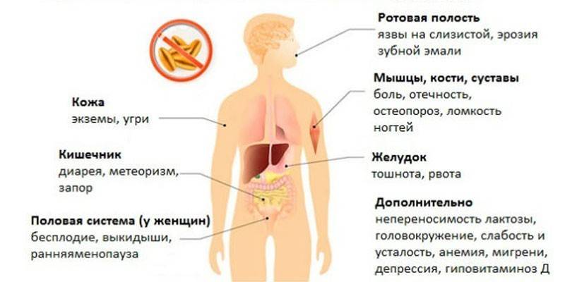 Симптомы непереносимости глютена
