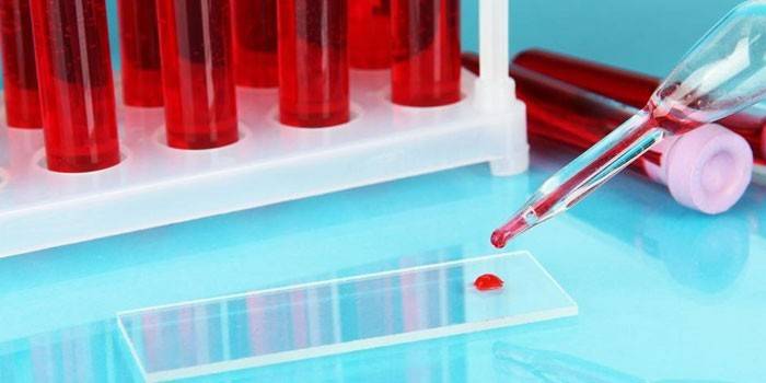 Анализы крови в пробирка и капля на лабораторном стекле