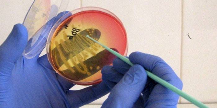 Чашка Петри с бактериями в руках у лаборанта