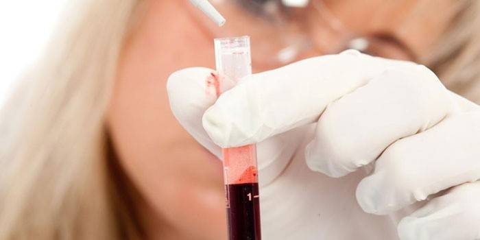 Лаборант делает анализ крови