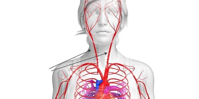 Сонные артерии в организме человека