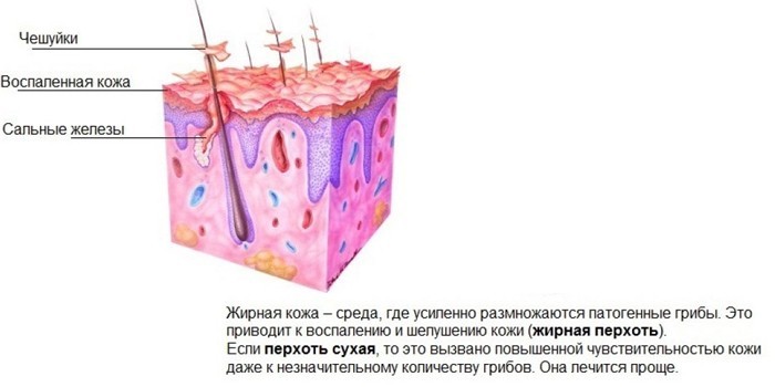 Причины появления перхоти