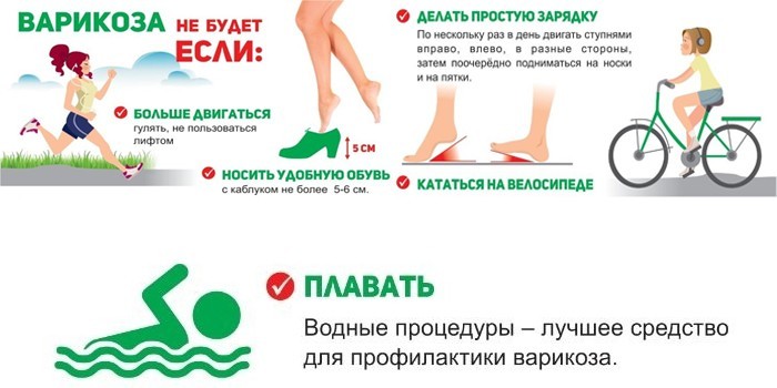 Профилактика варикоза