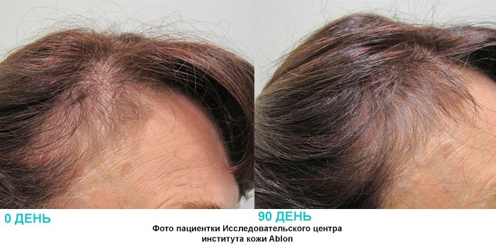 Фото пациентки доктора Аблона